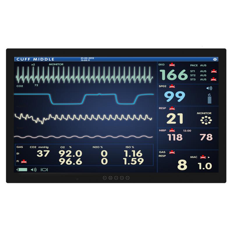 Onyx ACCEL Panel PC 32&rdquo; 4K UHD Smart View AMD Ryzen Embedded V1000 Multi-Touch