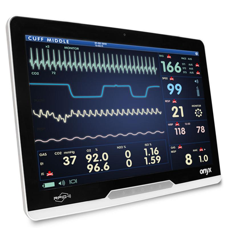 Onyx Mate2 22&ldquo;, i5-13500TE, 16GB RAM, kapazitiv, 256GB SSD, Windows 11 IoT Enterprise (D)